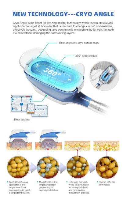 Aparat Criolipoliza 360°cu 5 Capete Ajustabile, Cavitatie, Radiofrecventa si Lipolaser pentru slabire, anticelulita, tonifiere si lifting