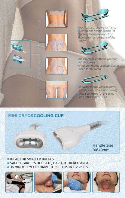 Aparat Criolipoliza 360°cu 5 Capete Ajustabile, Cavitatie, Radiofrecventa si Lipolaser pentru slabire, anticelulita, tonifiere si lifting