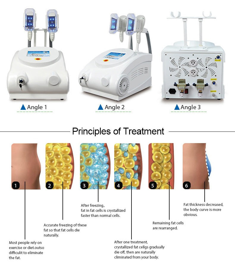 Aparat Criolipoliza Crioterapie cu 2 Capete, Cryneo