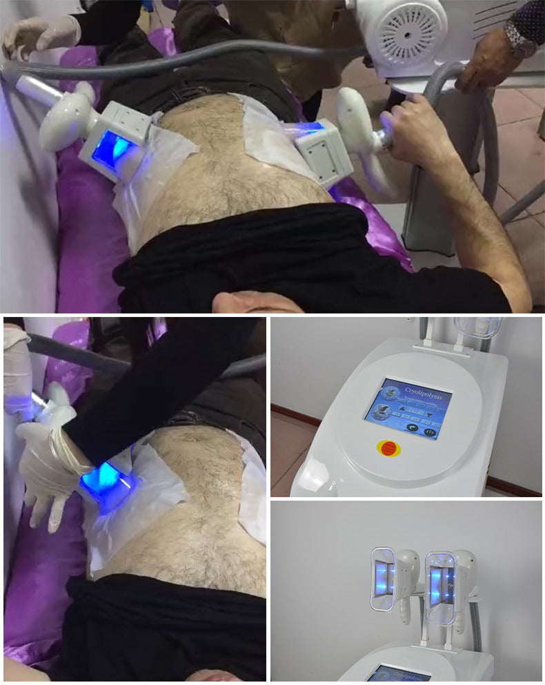 Aparat Criolipoliza Crioterapie cu 2 Capete, Cryneo