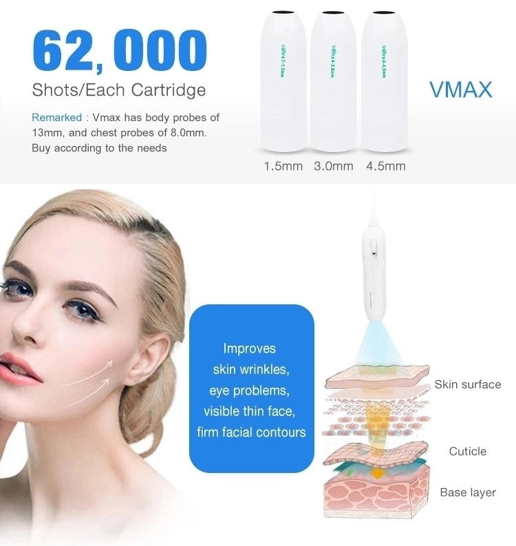 Aparat Hifu+VMax+Liposonix - Rezultate Uimitoare de la prima sedinta. Antirid, Lifting,Vergeturi