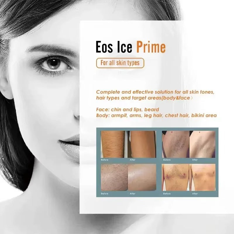 Aparat Profesional pentru Epilare Definitiva cu Dioda Laser, 4 lungimi de unda 755nm+808nm+940nm+1064nm, ProLaser, 3500W, cu doi manipuli