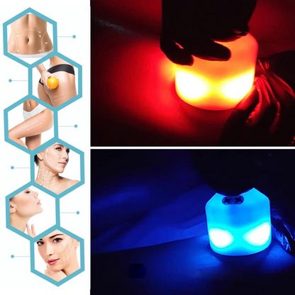 Aparat Profesional pentru Slabit si Celulita, Cryoshock crioterapie, inghetare grasimilor, reducerea tesutului adipos - aparat de criolipoliza
