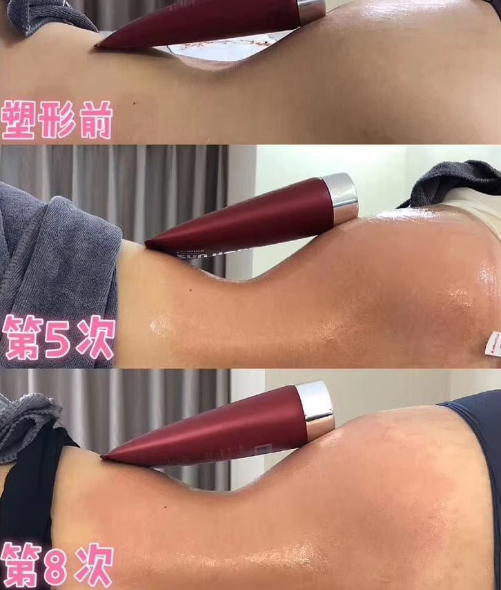 Aparat Remodelare Corporala Slimfit