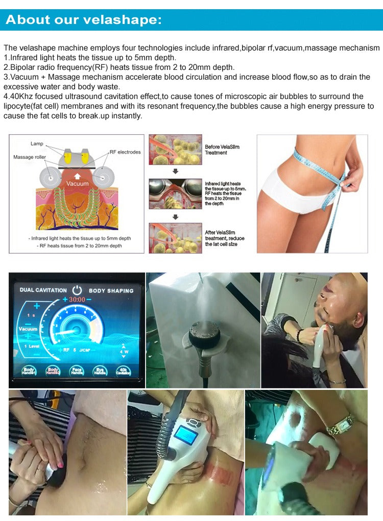 Aparat Vacuum Endermologic V-Sculptor cu Cavitatie, Radiofrecventa si Infrarosii pentru tratamente faciale si corporale