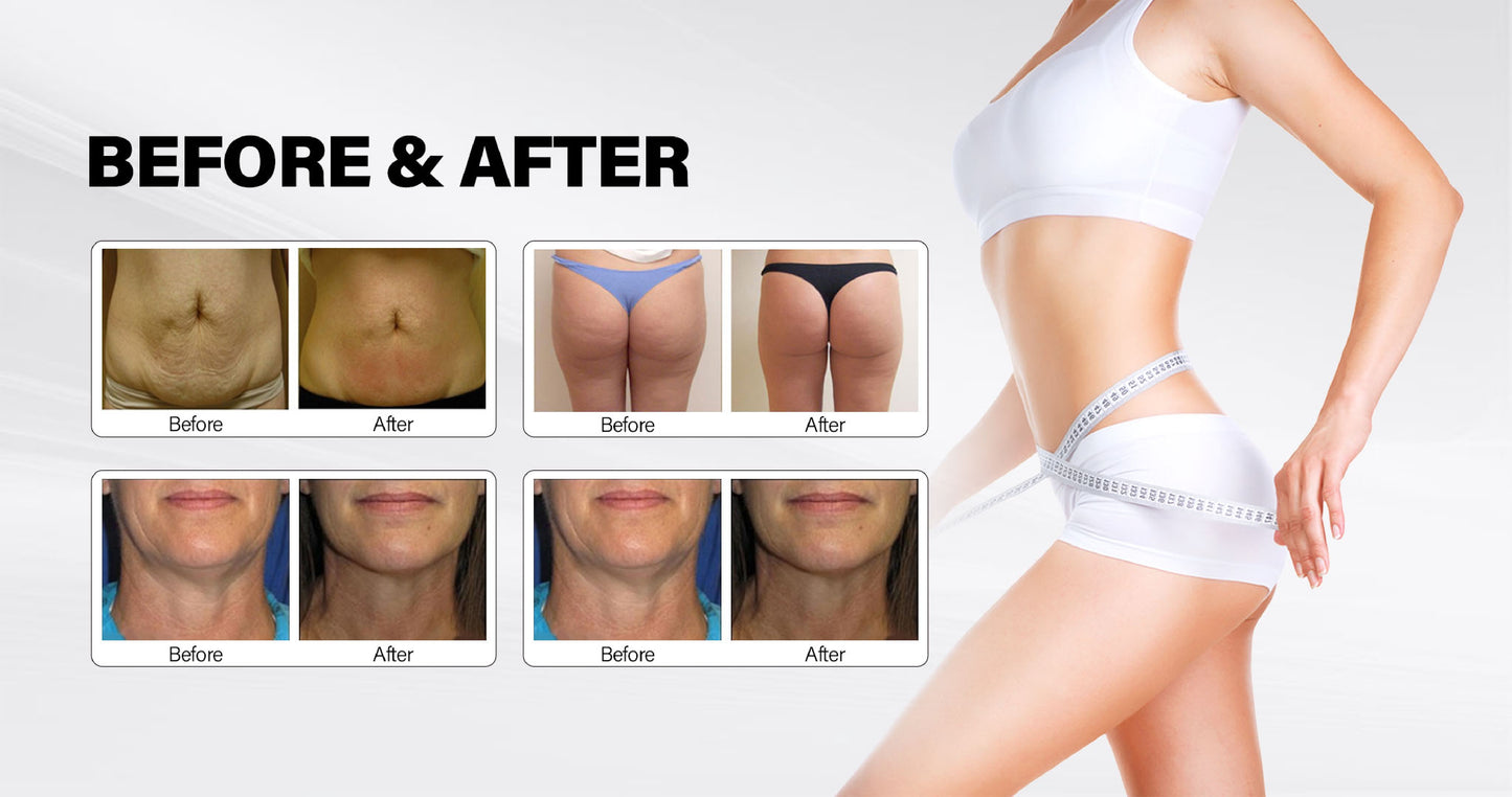 DermaSculpt 6 în 1 – Aparat profesional pentru remodelare corporală și rejuvenare facială (Vacuum Endermologic, Roller, RF, IR, Cavitație, Masaj Rotativ)