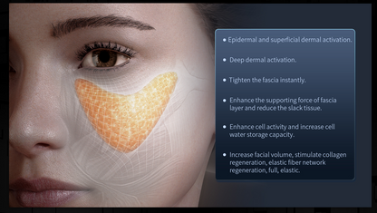 Hifu 12D Max -  Ultima Generatie - Rejuvenare, Reintinerire, Lifting Facial si Corporal