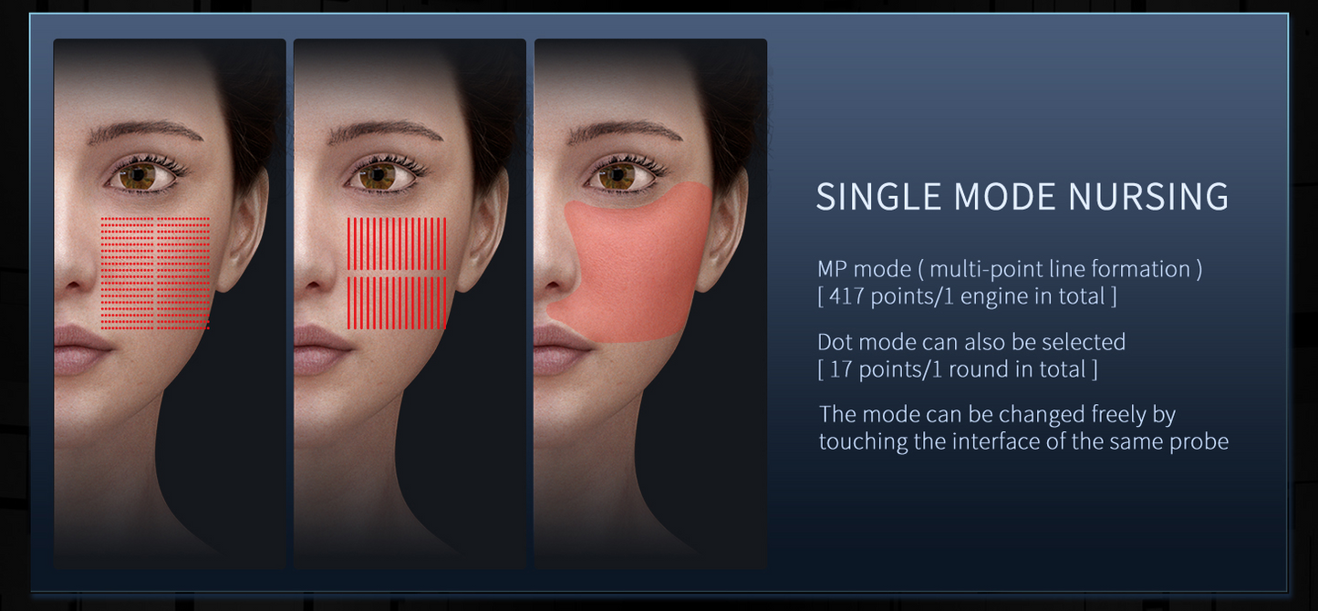 Hifu 12D Max -  Ultima Generatie - Rejuvenare, Reintinerire, Lifting Facial si Corporal