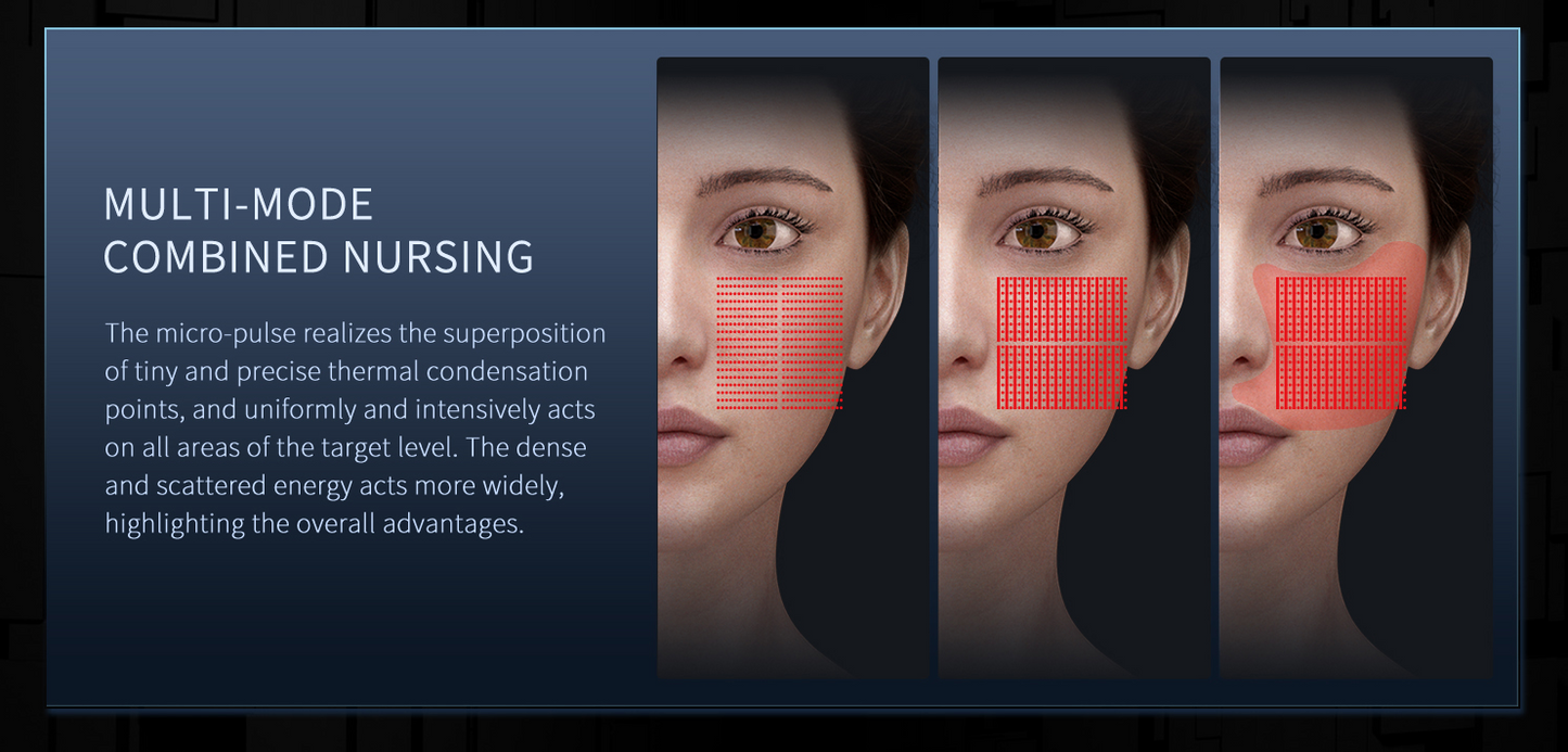 Hifu 12D Max -  Ultima Generatie - Rejuvenare, Reintinerire, Lifting Facial si Corporal