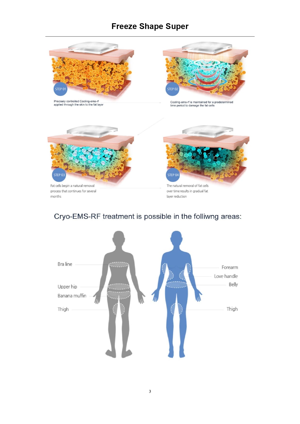 Super Shape Freeze Lipo - Aparat Electrostimulare, Radiofrecventa si Criolipoliza